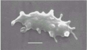 Cell Wall–Deficient Bacteria – Microbe Online