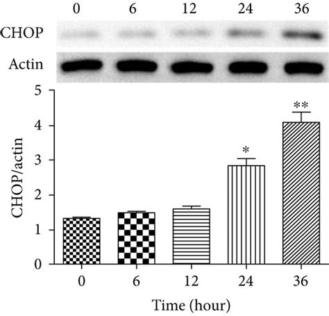 Hcy Induced The Expression Of ER Stress Related Proteins In HUVEC In A