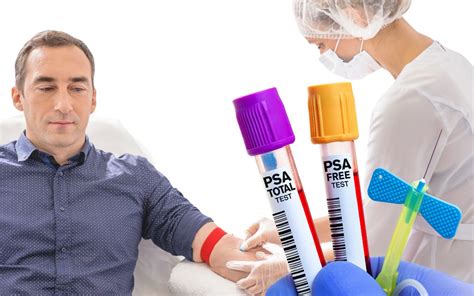 Preparação Para O Exame De Psa - O que é exame PSA e como ele ajuda a salvar vidas