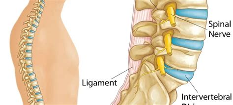 Herniated Disk Symptoms Prevention Treatment Dr Varun Aggarwal