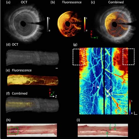 Endoscopic Multimodality Oct And Fluorescence Imaging Probe A