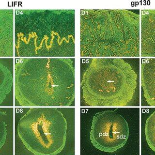 Analysis Of Expression Of Soluble LIFR And Gp130 In The Mouse Uterus