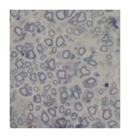 ((a), (b), and (c)) HE staining of transverse nerve slices from each... | Download Scientific ...