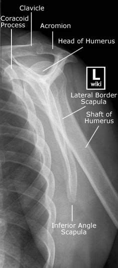 Lateral View Shoulder X Ray Axillary View Shoulder Positioning