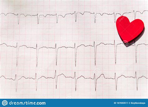 Close Up Of An Electrocardiogram In Paper Form Vith Red Wooden Heart