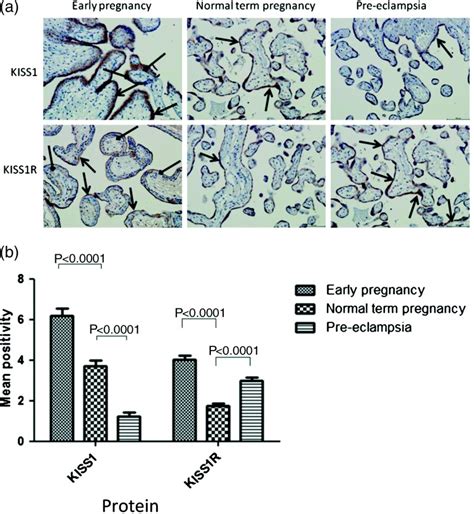 A Photomicrographs To Show Placental Expression Of Kiss1 And Kiss1r