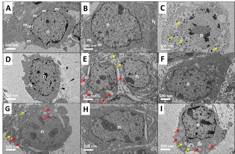 High Resolution Transmission Electron Microscopy HRTEM Micrographs Of