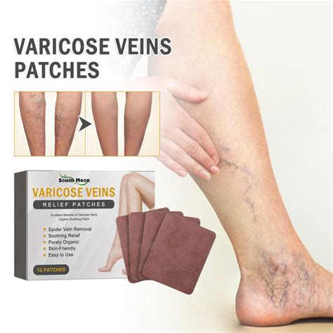 Duytu 12pcs Varicose Vein Massage Plaster Leg Swelling Pain Relief