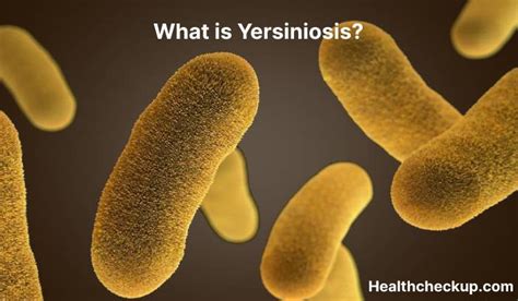 Yersiniosis - Symptoms, Diagnosis, Treatment, Prevention - Health CheckUp