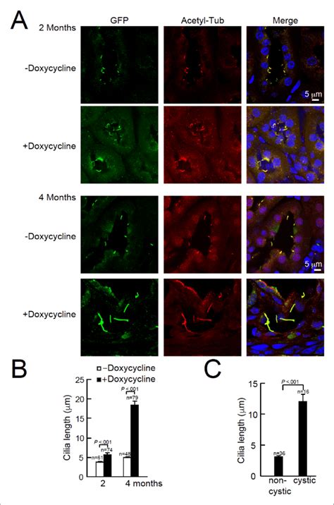 Cystic Kidney Cilia Are Abnormally Long Compared To Unaffected Tubules