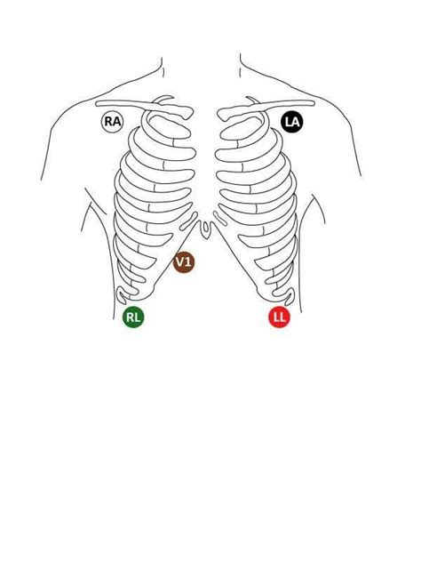 Nursing guidelines : Cardiac telemetry