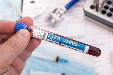 Virus Zika Apa Itu Bagaimana Cara Penularannya Dan Apa Saja Gejalanya