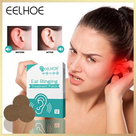 Eelhoe Ear Tinnitus Treatment Patch Deafness Ear Swelling Buzzing