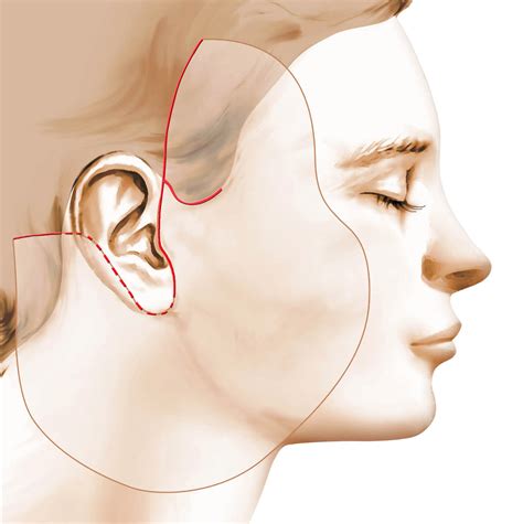 Le Lifting Cervico Facial Ou Lifting Du Visage Et Du Cou Chez La Femme