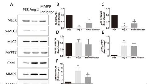 The Matrix Metalloproteinase 9 MMP9 Inhibitor SB 3CT Increased