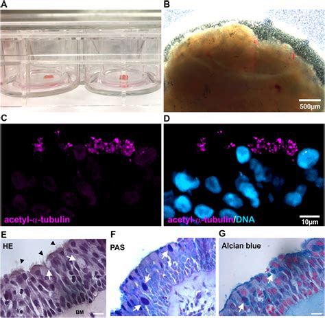 Cultured Human Nasal Slices Show Unimpaired Epithelium Containing