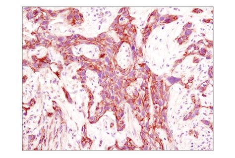 Cadherin Catenin Antibody Sampler Kit Cell Signaling Technology