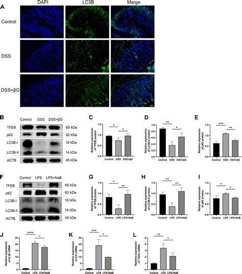 Frontiers Oat Beta Glucan Reduces Colitis By Promoting Autophagy Flux