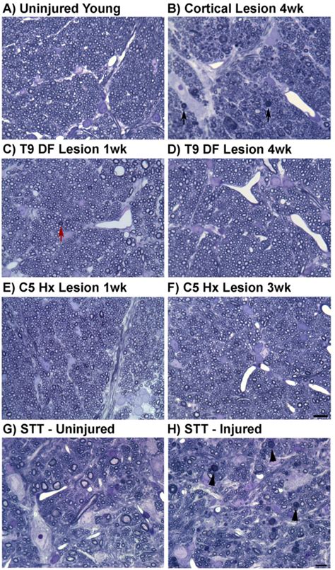 Histological assessment of myelinated axons in the pyramid following ...