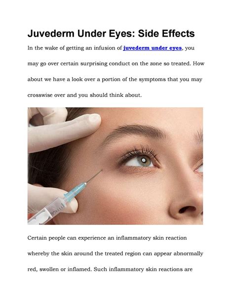 Juvederm Under Eyes: Side Effects by Inkarn Inkarn - Issuu