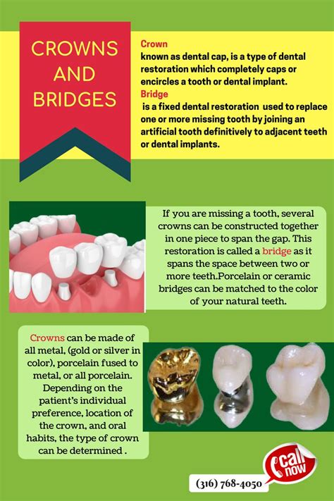 Bridge For Your Teeth - The Architect