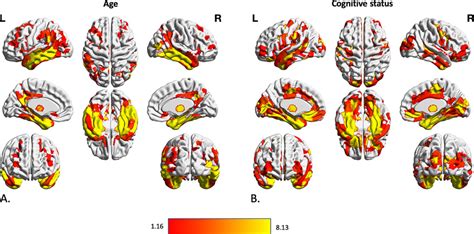 Association Between Volumetric Data Of Cortical And Subcortical Parcels