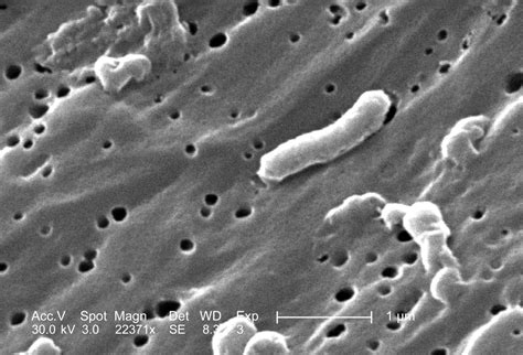 Cholera-Bakterien (Vibrio cholerae, Elektronenmikroskopie) - DocCheck