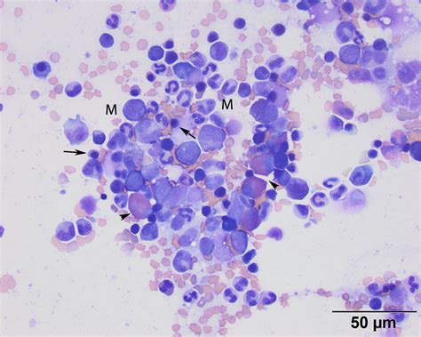 Eosinophils Eclinpath