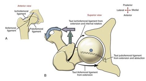 Femoral Neck Stress Fractures Knee And Sports Orthobullets