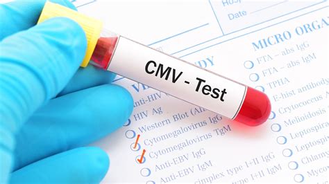 Le cytomégalovirus une infection virale fréquente et souvent méconnue