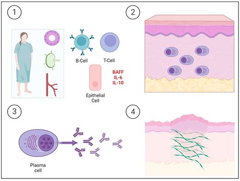 Ijms Free Full Text Localized Cutaneous Nodular Amyloidosis A