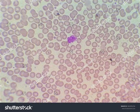 Blood Smear Under Microscope Present Basophil Stock Photo 584395234 ...