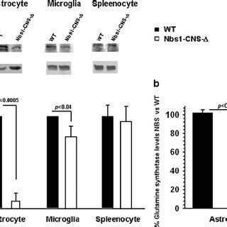 Nbs1 Deletion Attenuates DDR In Purkinje Neurons Confocal Micrographs