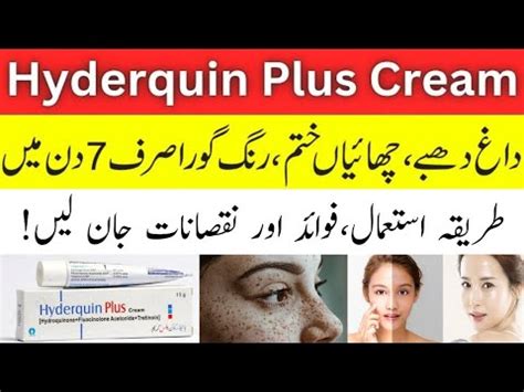 Hyderquin Plus Cream Uses In Urdu Hyderquin Plus Cream Side Effects