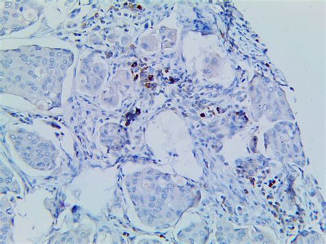 pax  antibody rbt pax bio sb