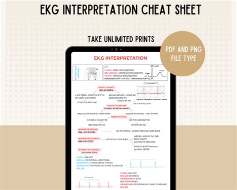 EKG Interpretation and Dysrhythmias EKG Cheat Sheet EKG Rhythm Ekg ...