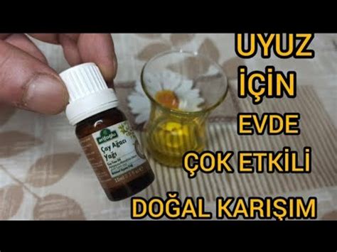 UYUZDAN NASIL KURTULDUM KESİN ÇÖZÜM UYUZ HASTALIĞI NASIL GEÇER çay