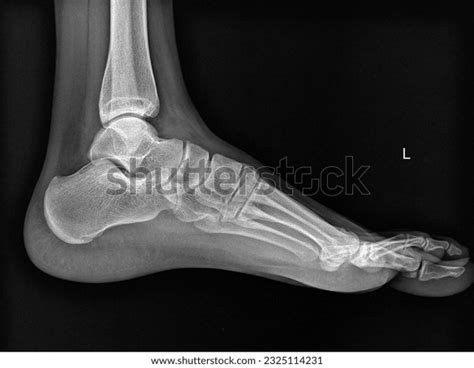 Lateral De Pie Normal Humano De Foto De Stock 2325114231 Shutterstock