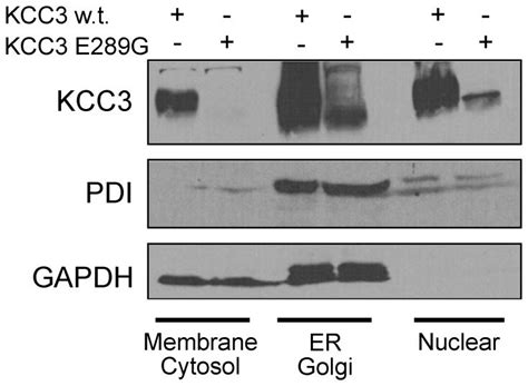 Hek 293ft Cells Were Transfected With Wild Type Kcc3 Or Kcc3 E289g