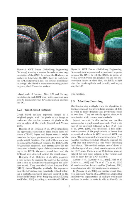 Automatic Segmentation Of The Optic Nerve Head Region In Optical