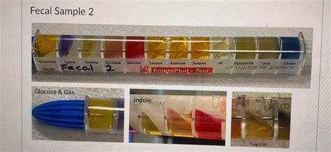 Fecal Sample 1: Fecal Sample 2 Fecal Samnle ? | Chegg.com