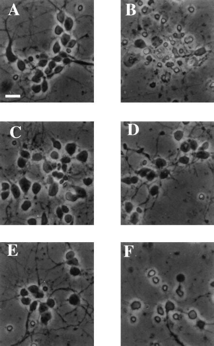 Photomicrographs Of Cultured E18 Cortical Neurons Treated With