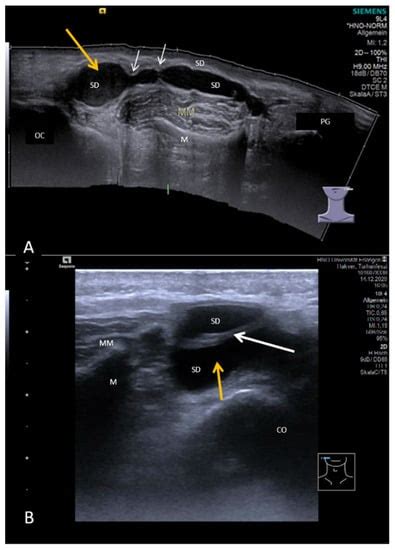 Jcm Free Full Text Ultrasound In Inflammatory And Obstructive