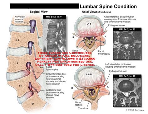 Medical Exhibits, Demonstrative Aids, Illustrations and Models