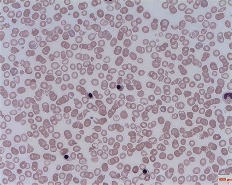 Nucleated red blood cell - Alchetron, the free social encyclopedia