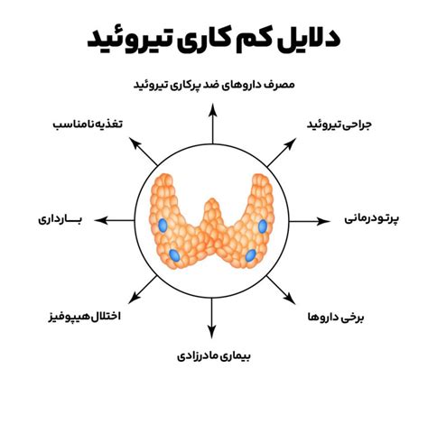 کم کاری تیروئید راهنمای کامل علائم، علل، تشخیص و درمان