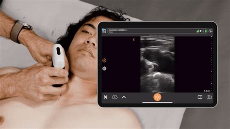 Ultrasound For Subclavian Central Line Placement Clarius