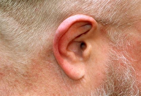 Tinnitus Ursachen Und Therapie Gesundheit