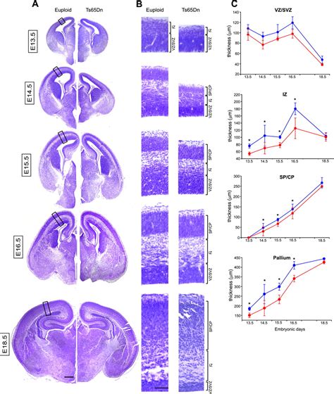 Defects In Embryonic Neurogenesis And Initial Synapse Formation In The