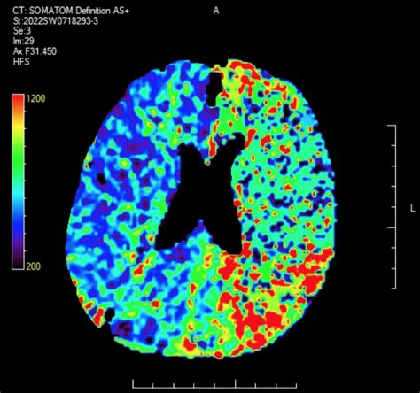 Ct Case Litfl Ct Scan Interpretation